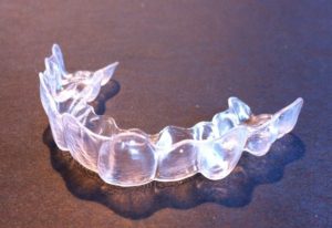 Invisalign New Lynn